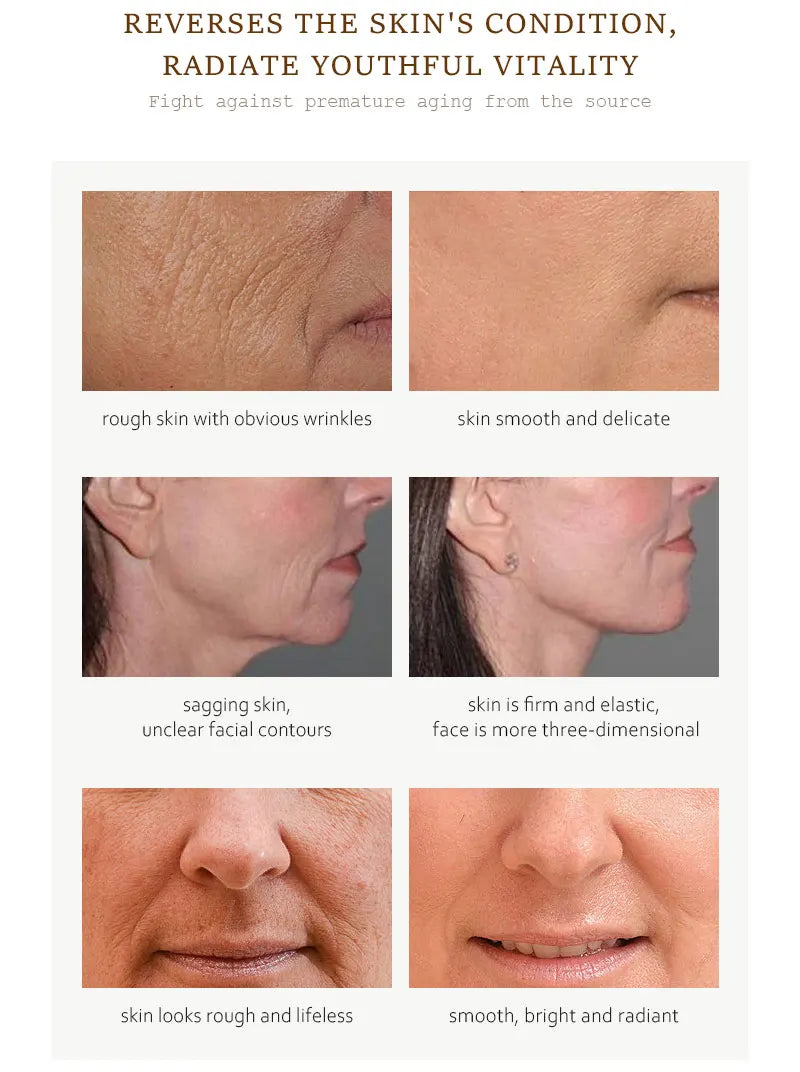 Before and after images showing skin improvements using Sheluxe retinol collagen face serum for wrinkles and firmness