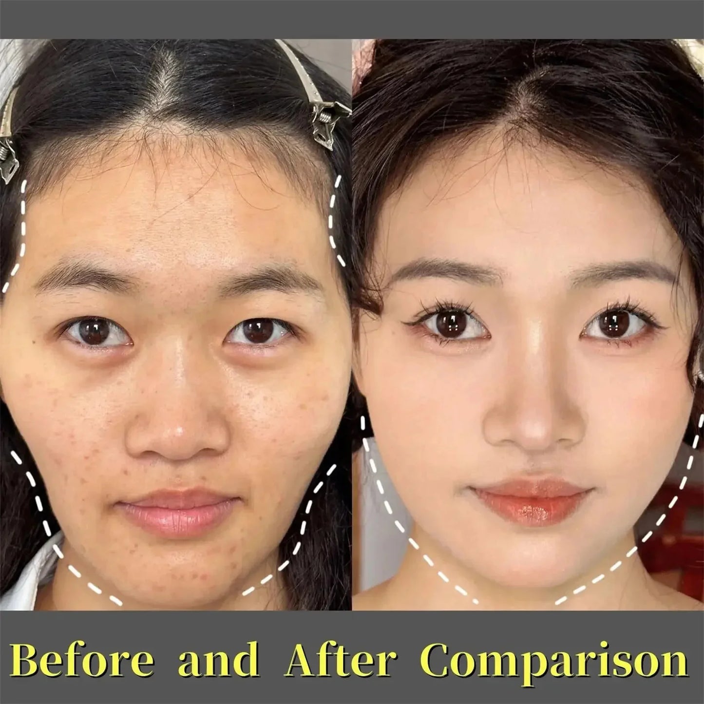 Before and after comparison showing clear skin improvement using deep nourishing facial wrinkle patches