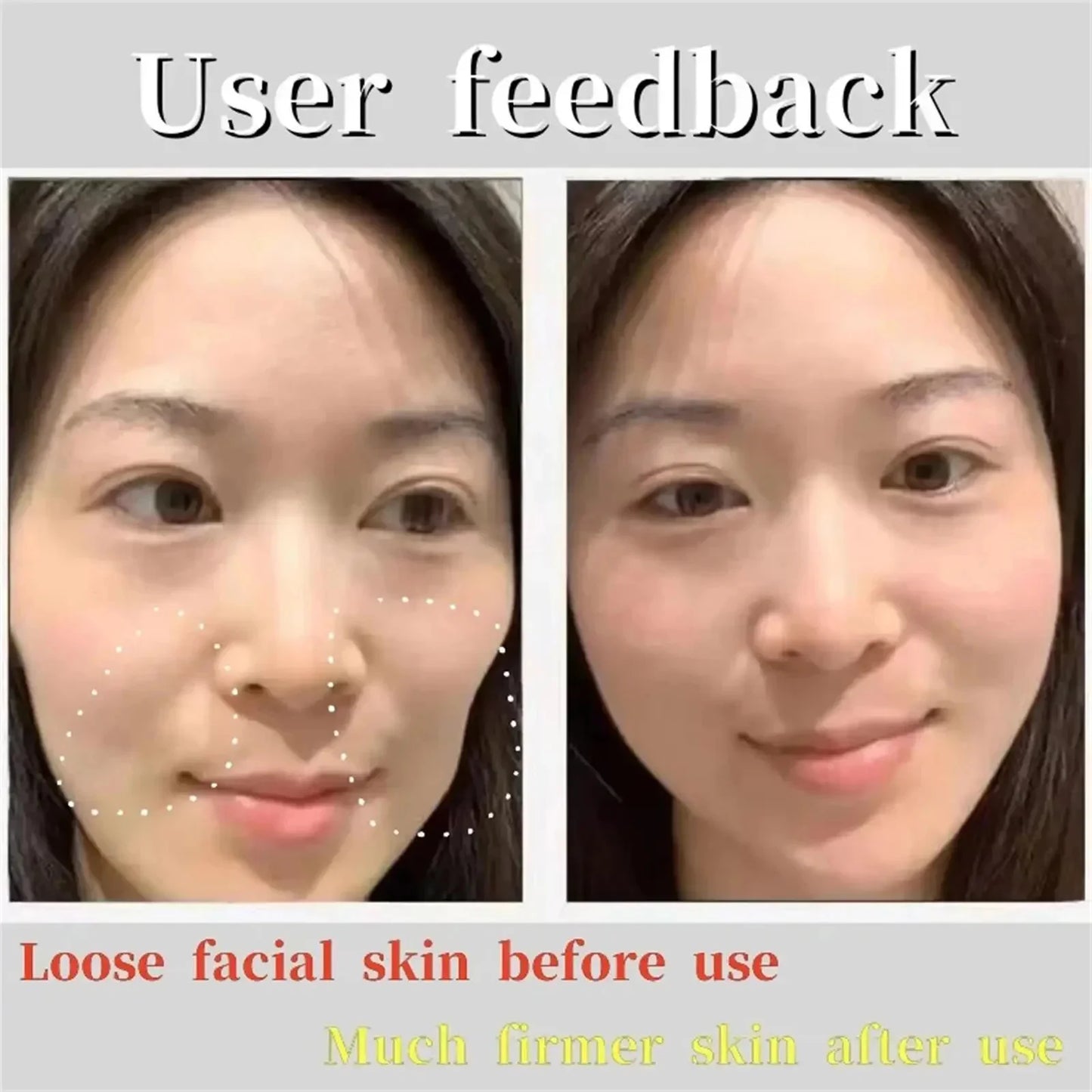 Before and after user feedback showing firmer skin with deep nourishing facial wrinkle patches by Sheluxe