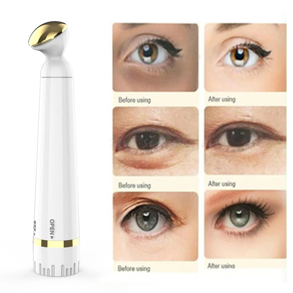 Sheluxe anti ageing eye wrinkle remover device with before and after results on eye wrinkles and dark circles