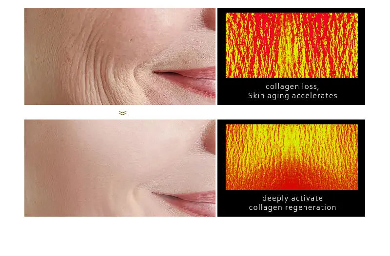 Before and after close-up of facial skin showing reduced wrinkles using retinol collagen face serum by Sheluxe