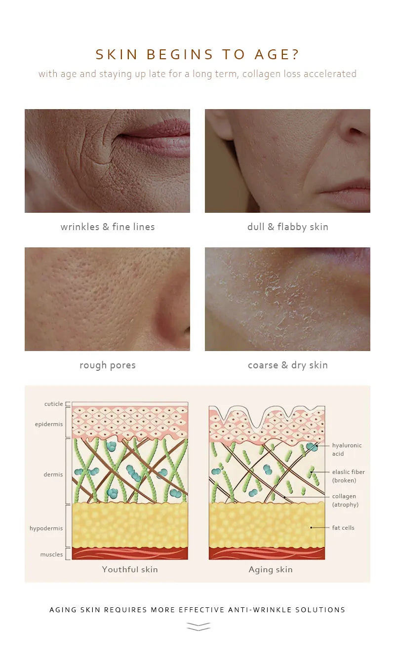 Diagram showing aging skin effects like wrinkles, dull skin, rough pores and dry skin, promoting retinol collagen face serum