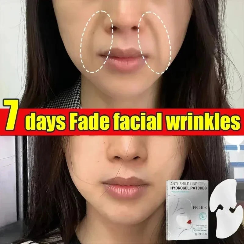 Before and after images showing wrinkle reduction using Sheluxe deep nourishing facial wrinkle patches
